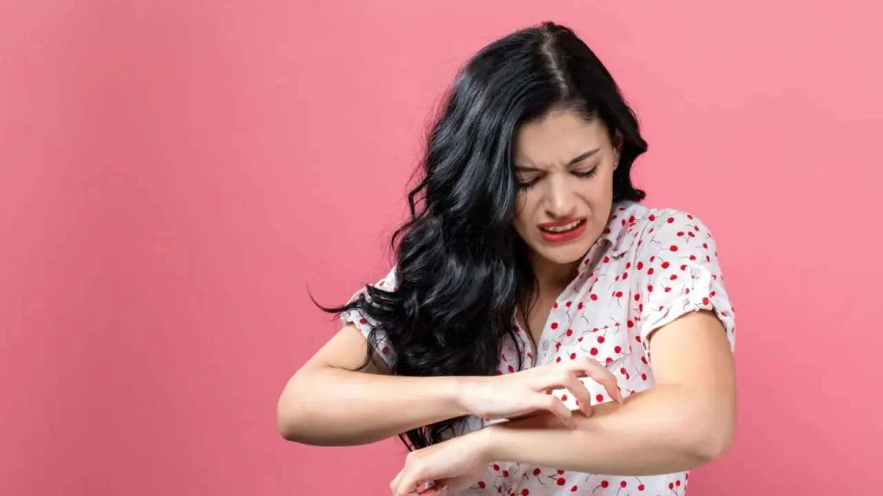 How to Cure Summer Heat Rash and Skin Inflammation know expert s Advice