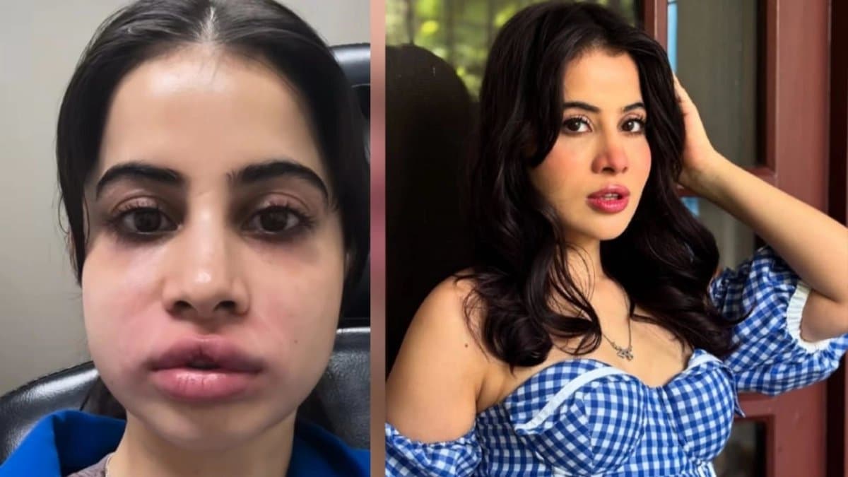 Urfi Javed shared her pictures of new face without fillers