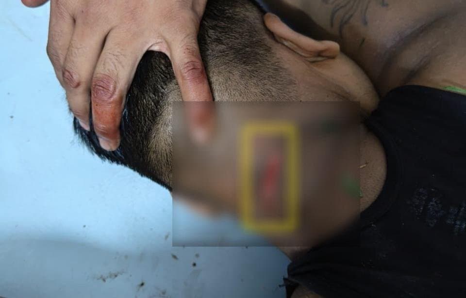 Bangladeshi smugglers attack bsf jawan one seriously injured