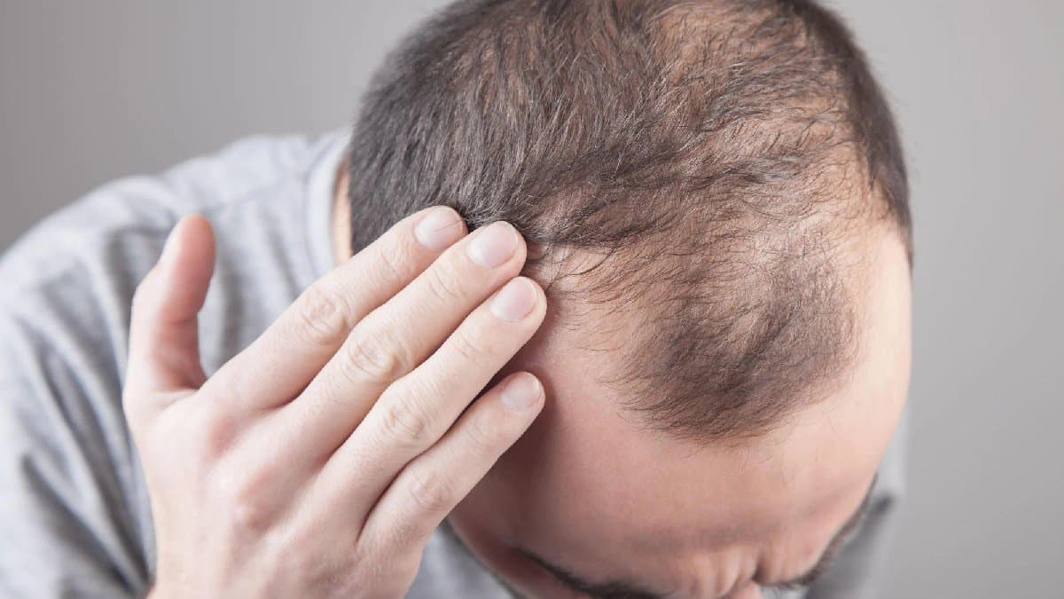 Can Washing Hair with Hot Geyser Water Cause Baldness lif