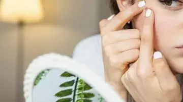 Womans Pimple On Forehead Turns Out To Be Skin Cancer gnr