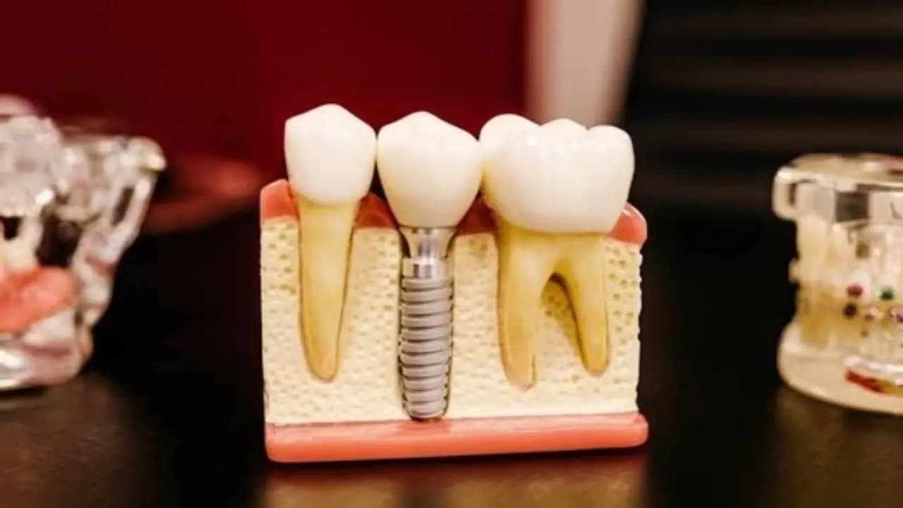 Dental Warning Signs: 5 Critical Oral Symptoms That Signal Serious Internal Health Issues