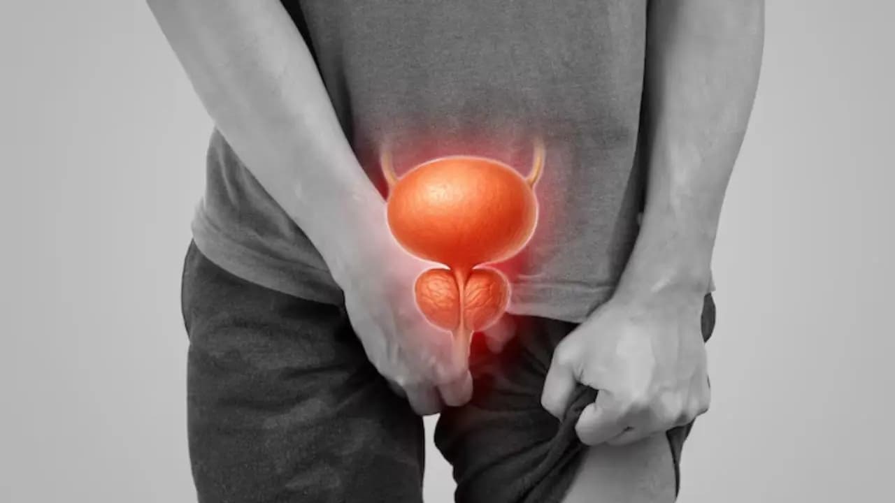 prostate cancer risk