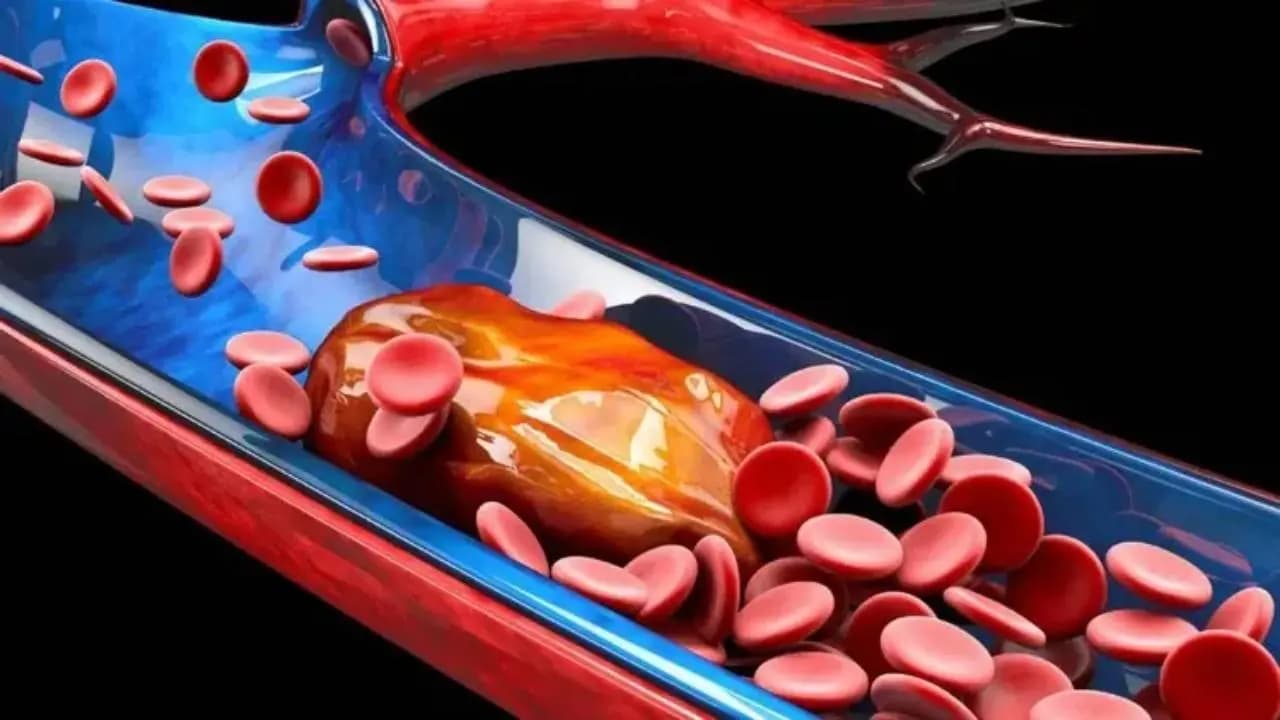 Gut Microbiome and Heart Disease: New Research Links Intestinal Bacteria to Cardiac Risks