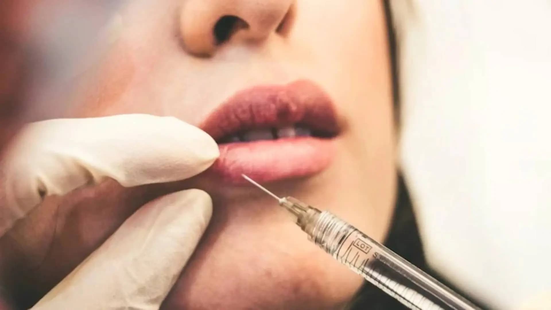 US Women Use Cadaveric Fat Injections From Dead Bodies to Achieve Perfect Hourglass Figures