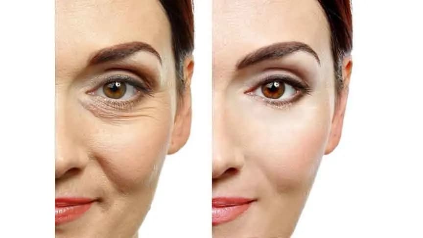 Coffee can improve your sagging skin tightened and make your skin wrinkle free