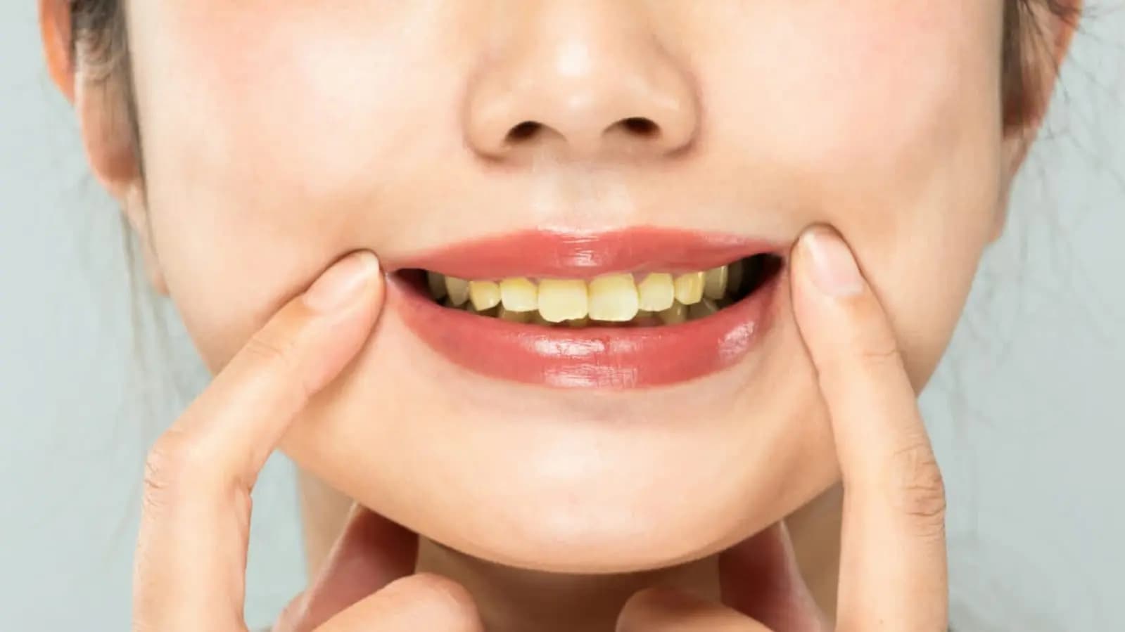 how to whitening yellow teeth lif
