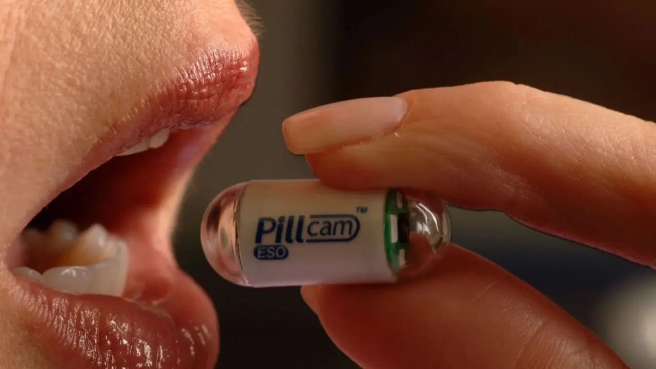 Capsule Endoscopy