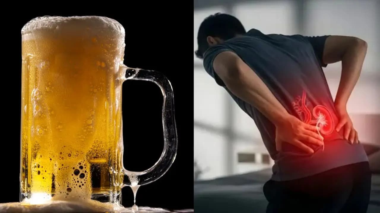 Kidney Stone