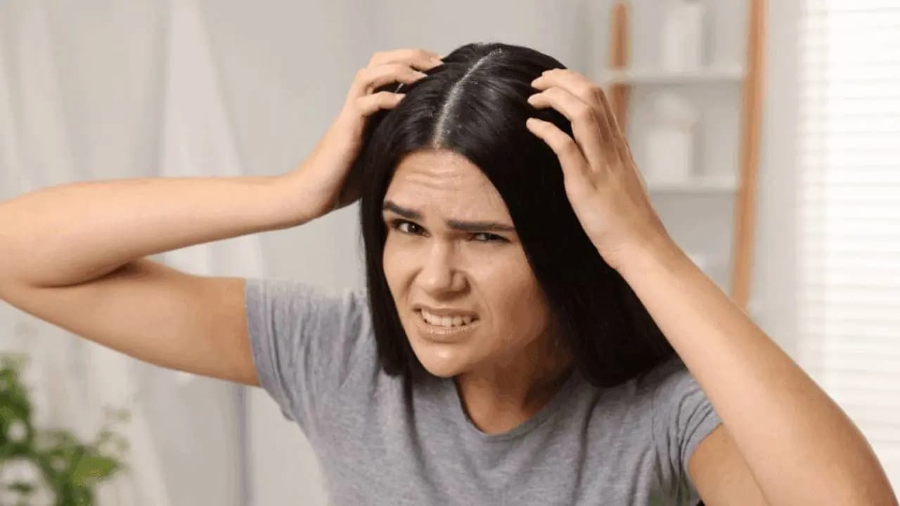 Summer Essential Scalp Care Tips to Prevent Fungal Infections