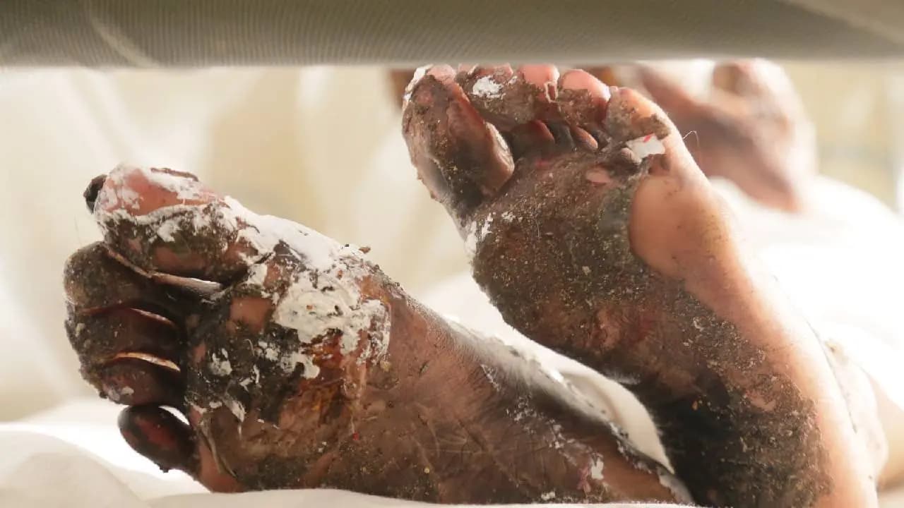 Mahua Roychoudhury Biopic: Ankita Mallick s Horrific Prosthetic Look Shakes Tollywood Sets