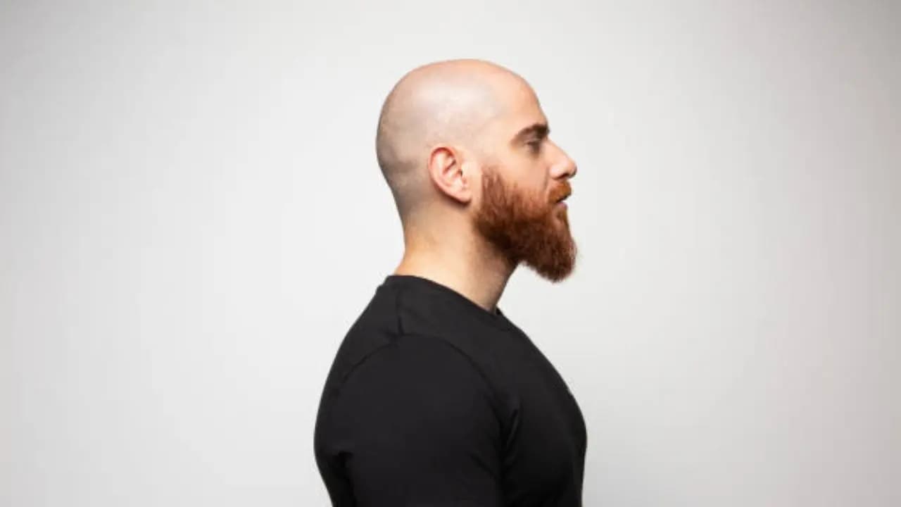 Gen z people are going bald faster and as a result this industry is increasing by leaps and bounds