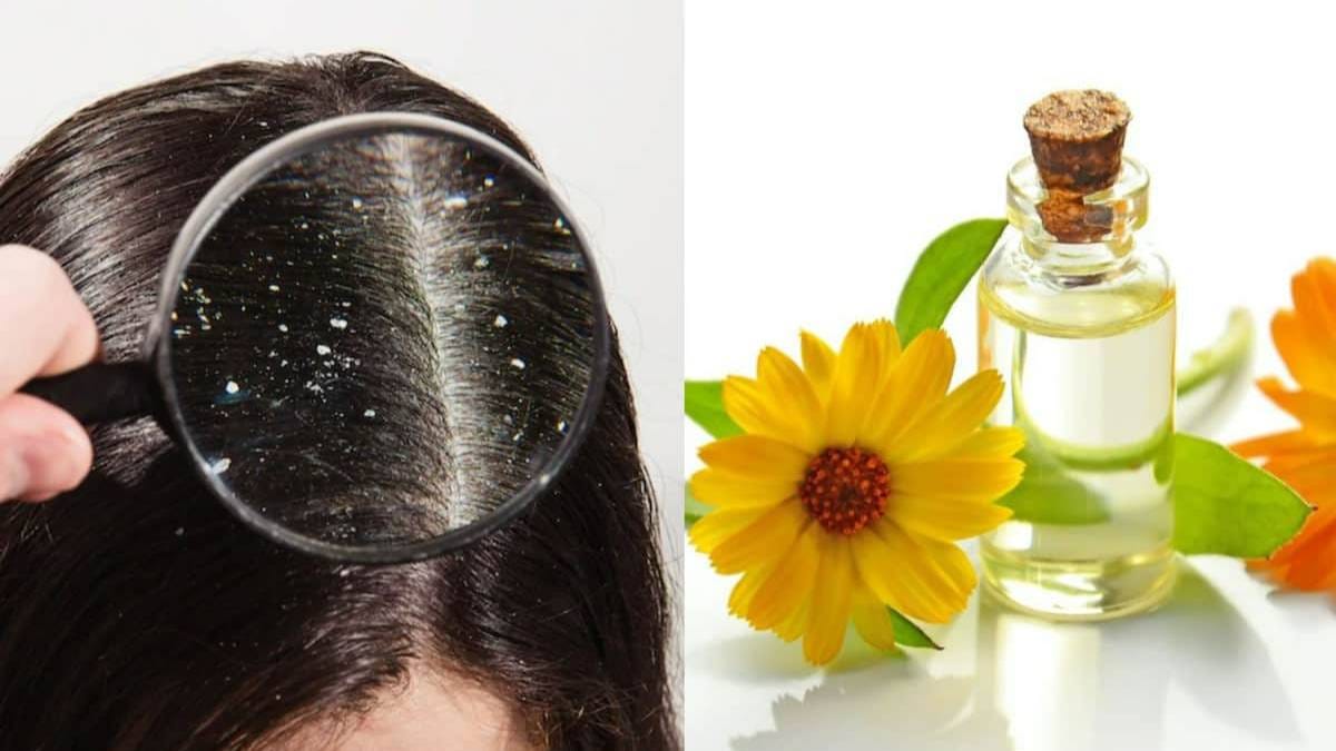 this home made natural hair oil can prevent dandruff problem increase hair growth and make your hair thick and shiny