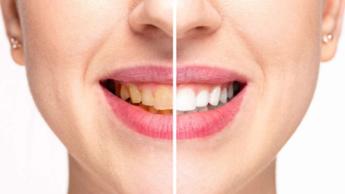 strong and healthythis home made natural remedy can prevent yellow shade of teeth prevent cavity and make your teeth