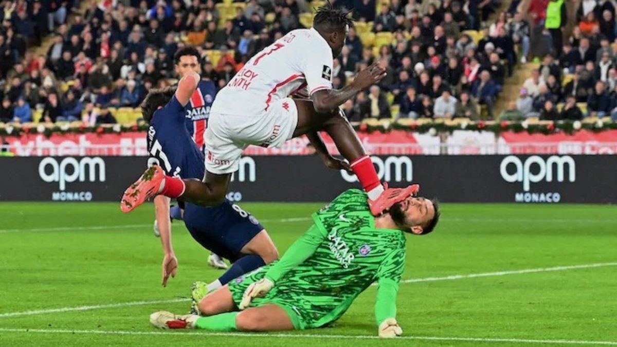 PSG goalkeeper Gianluigi Donnarumma with multiple cuts and facial trauma during a French league game against Monaco 