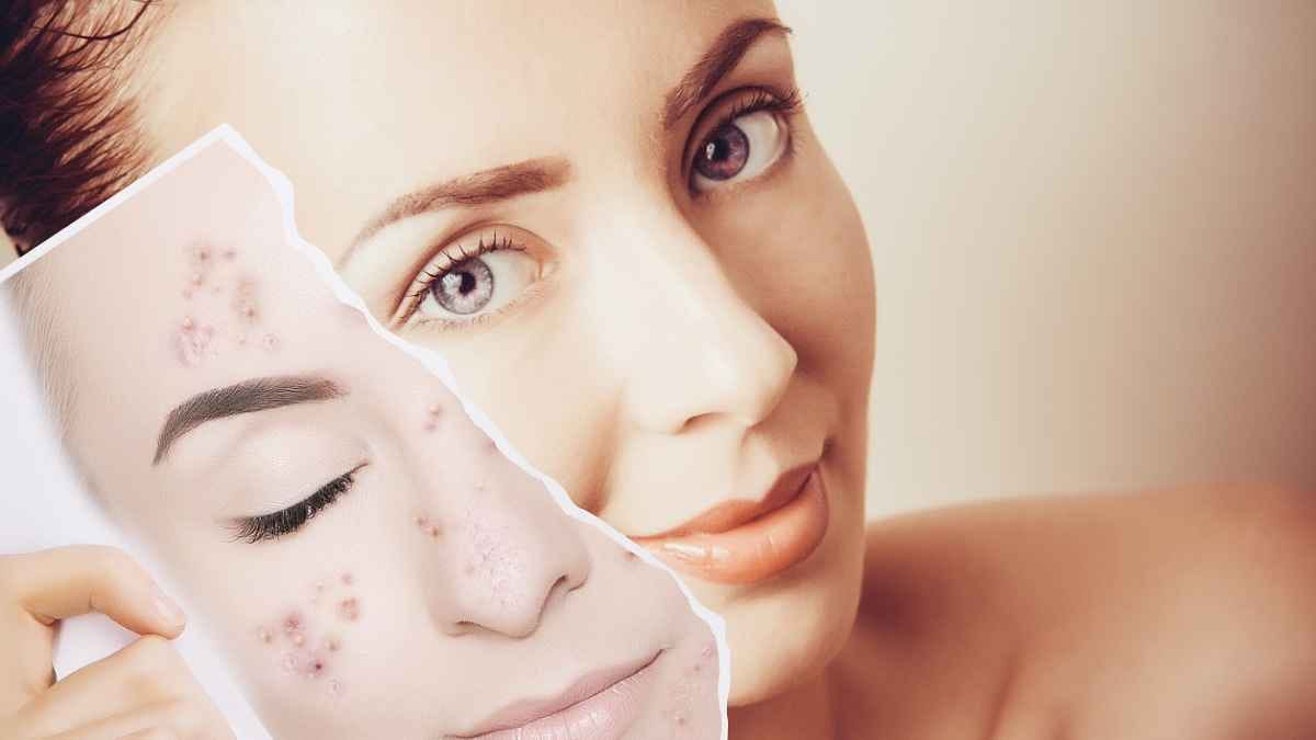 this home made natural face pack can remove sun tan wrinkles and make your skin glowing 