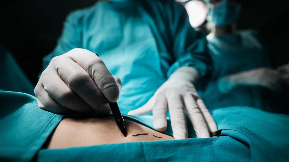 New York women are using non-surgical treatments for natural enhancements of their breasts