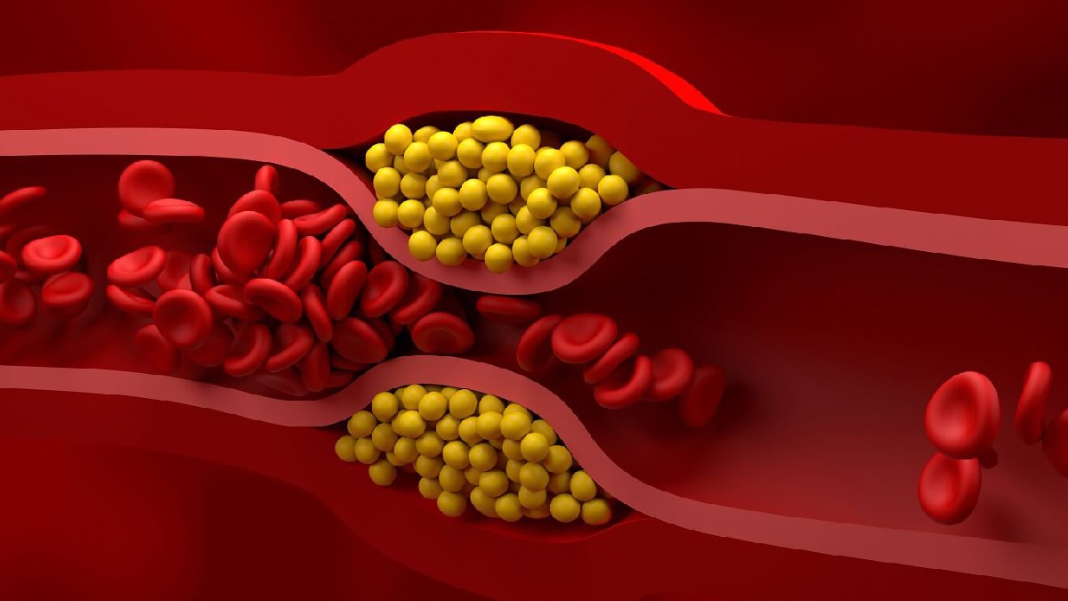 what is the difference between good and bad cholesterol lif