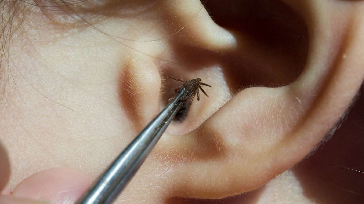 Steps you are supposed to take if a bug gets inside your ear